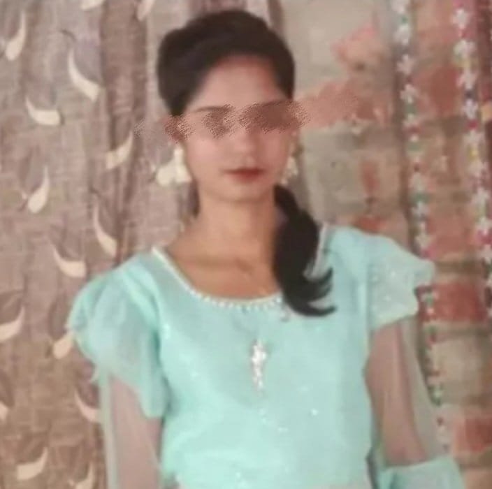 ब्रेकअप से नाराज़ प्रेमी से बना दरिंदा, प्रेमिका को केमिकल से जलाया