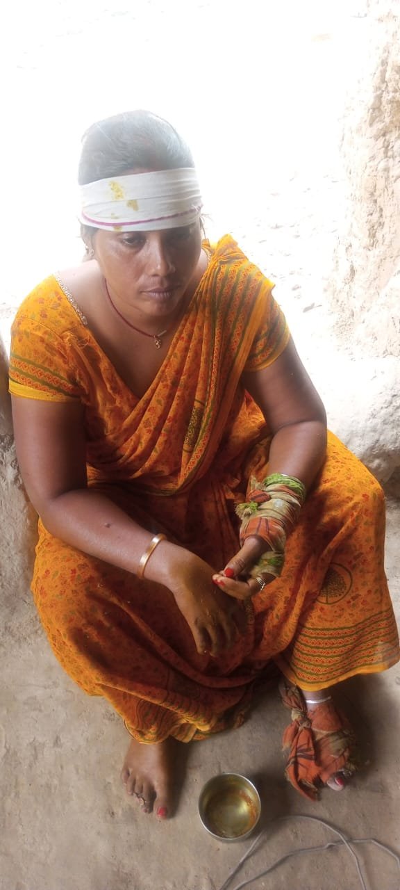 दीवार तोड़ने में हुई मारपीट, महरुआ पुलिस पर एक पक्षीय का लगा आरोप