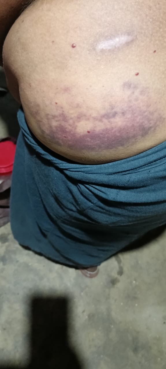 फसल चराने को लेकर महिला पर हमला, तीन दिन बाद भी पुलिस मौन