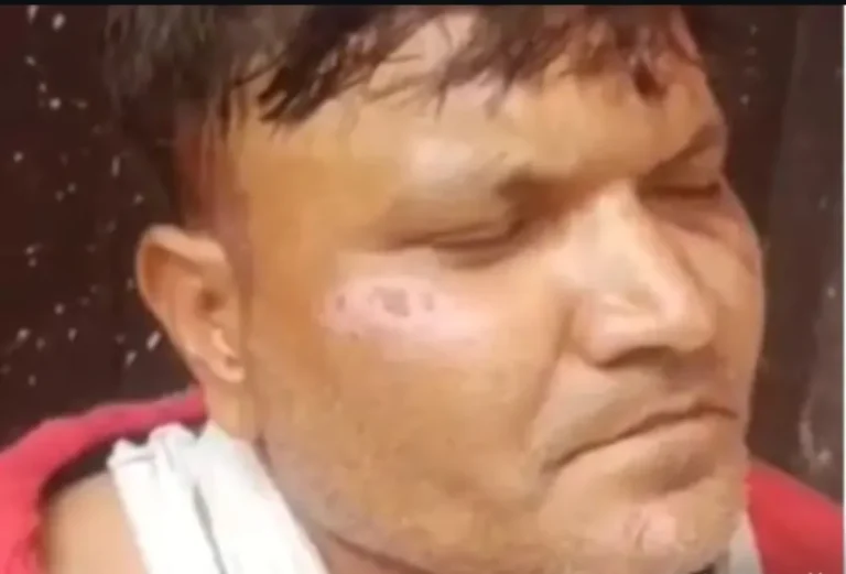 टांडा में नकली पिस्टल के दम पर ज्वेलर्स की दुकान में लूट का प्रयास, आरोपी गिरफ्तार